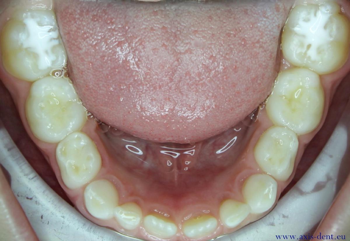 Čo musíte vedieť (a robiť), aby mali vaše deti zdravé zúbky bez kazu