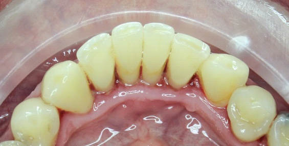 Ako mať zdravé a biele zuby po celý život - dentálna hygiena