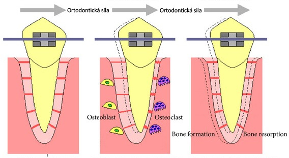 Ako pracujú strojčeky na zuby?