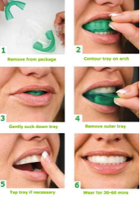 9 jednoduchých krokov k belším zubom,  ktoré môžete skúsiť už dnes