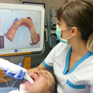 Video o skenovaní zubov